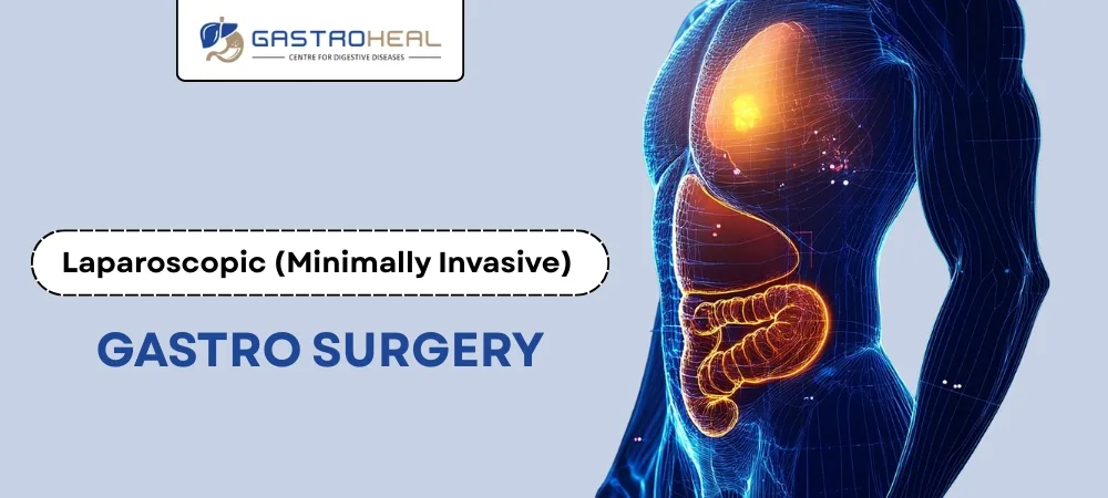 GI surgery in Gujarat