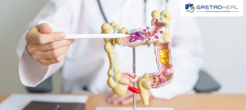 best gastro surgeon in Anand