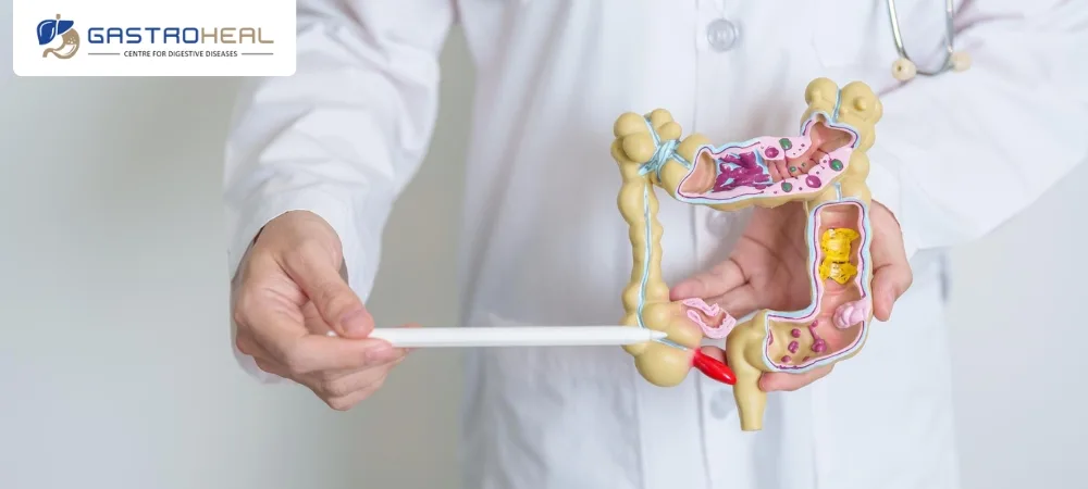 gastro surgeon in Anand