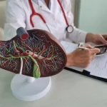 gallbladder and bile duct stones