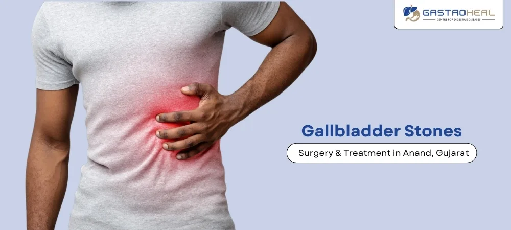gallstones treatment