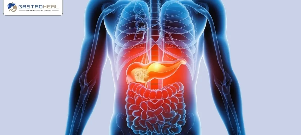 pancreas pain