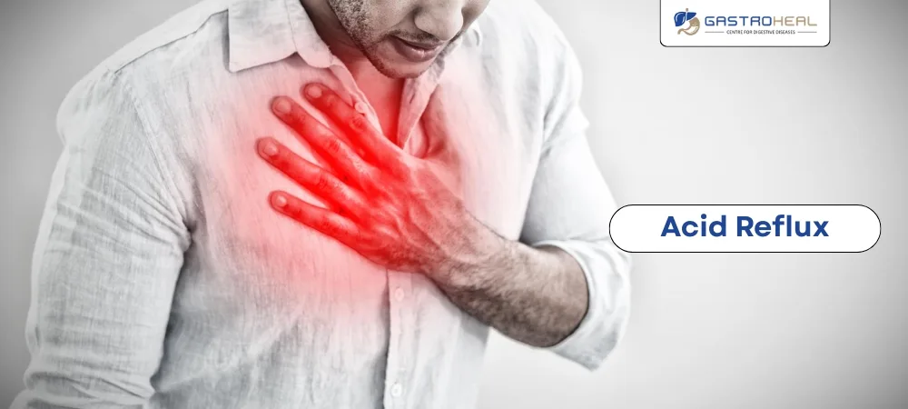acidity problem treatment
