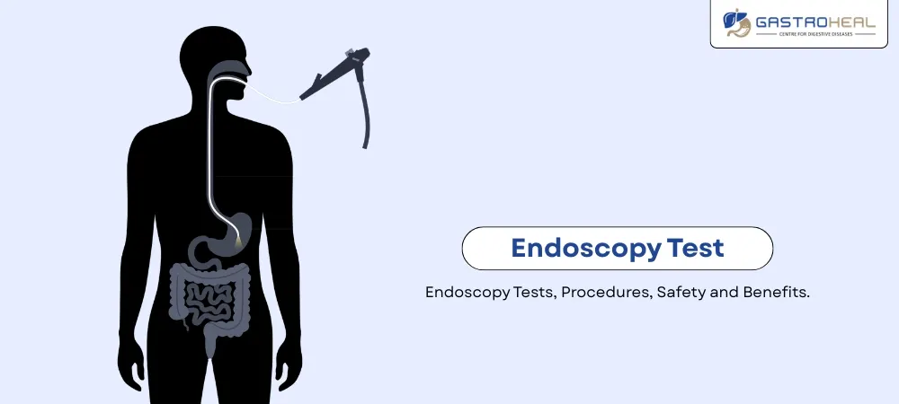 endoscopy procedure