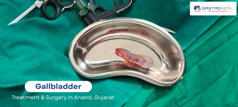 gallbladder surgery