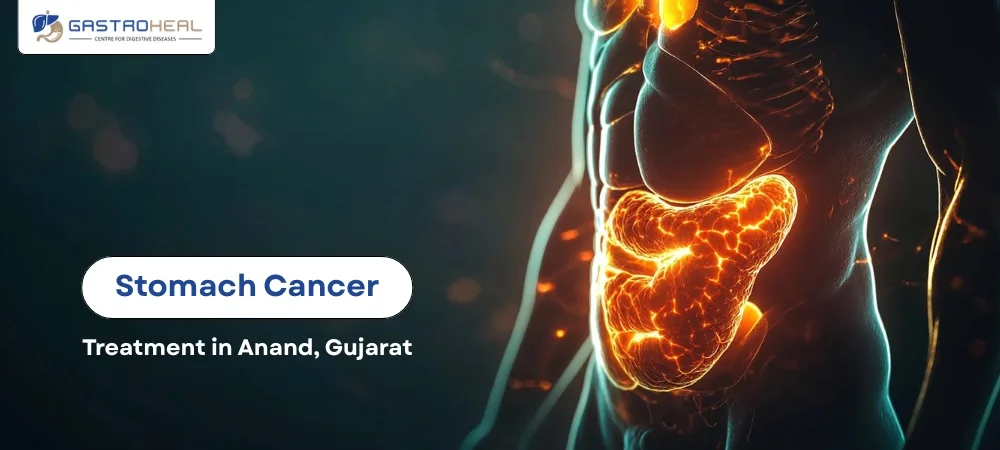 gastric cancer symptoms