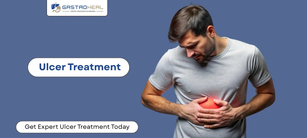 gastric ulcer causes