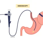is endoscopy painful