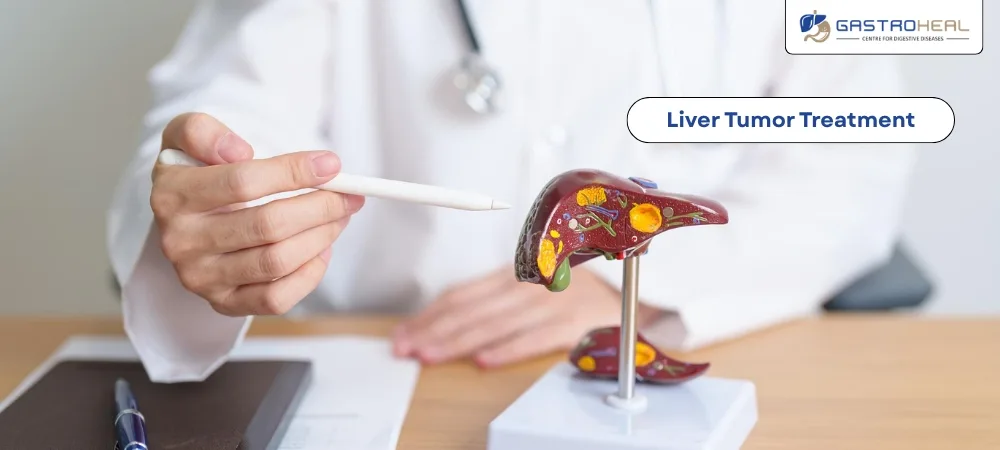 liver cancer surgery