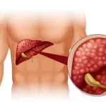 liver mass symptoms