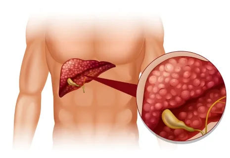 liver mass symptoms
