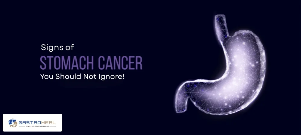 stomach cancer symptoms
