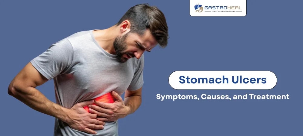 stomach ulcer symptoms