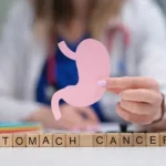 symptoms of stomach cancer in early stage