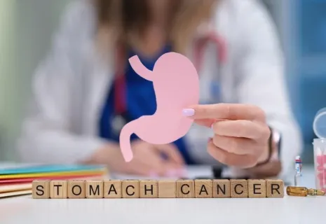 symptoms of stomach cancer in early stage