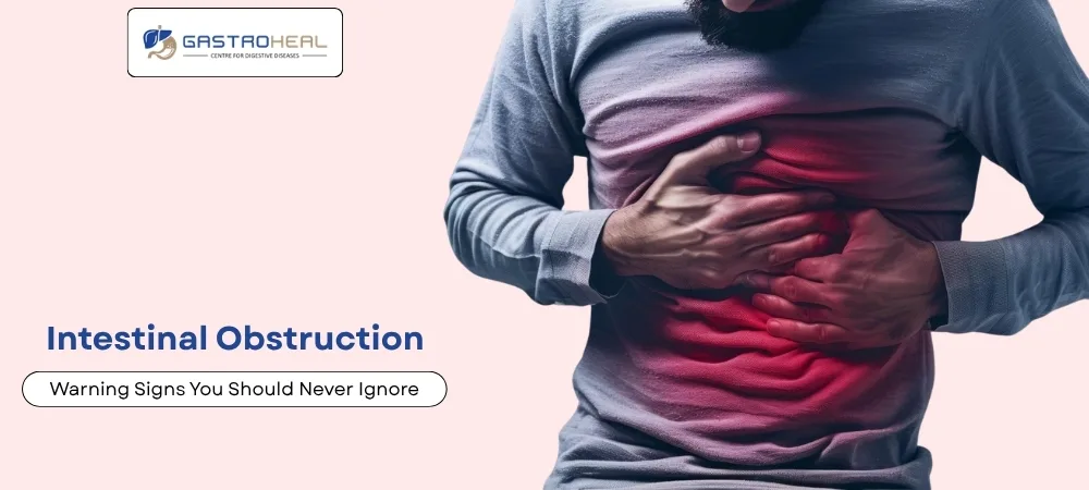 bowel blockage symptoms