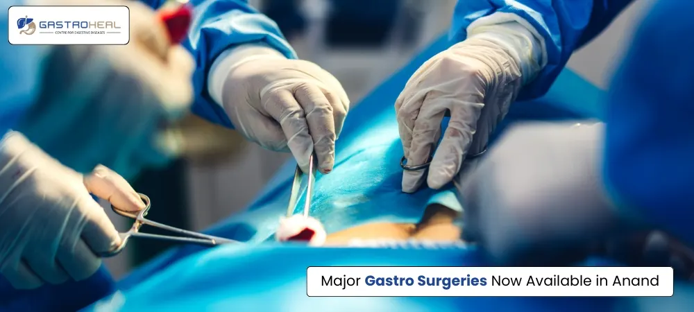gastro surgeon in Anand