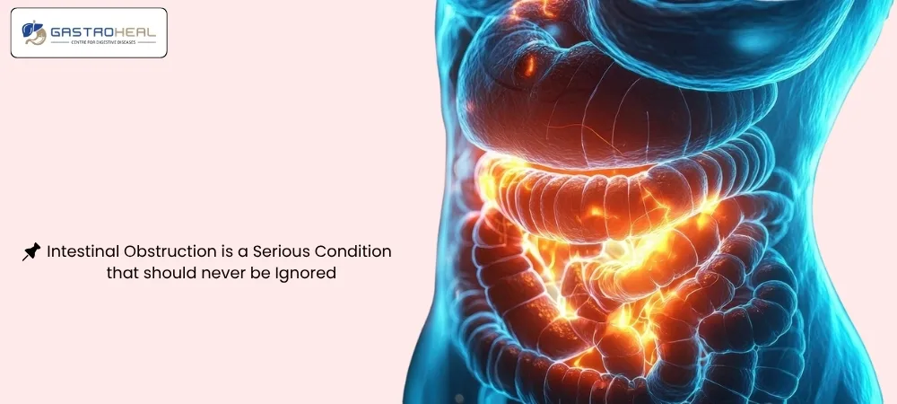 intestinal obstruction symptoms