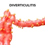 lower abdominal pain left side