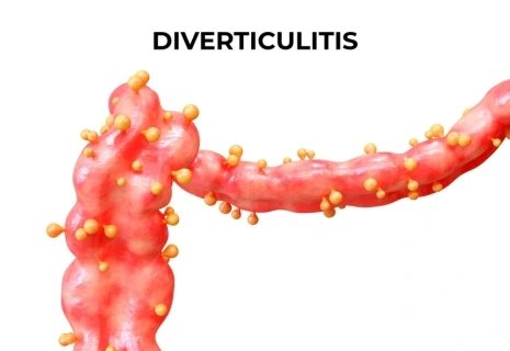 lower abdominal pain left side