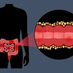 severe abdominal pain emergency