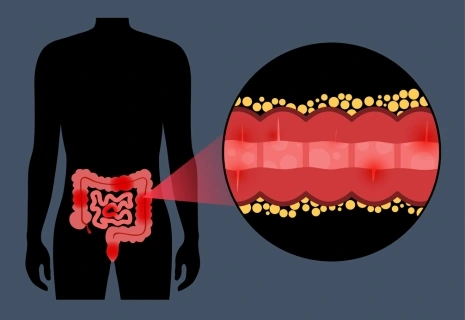 severe abdominal pain emergency
