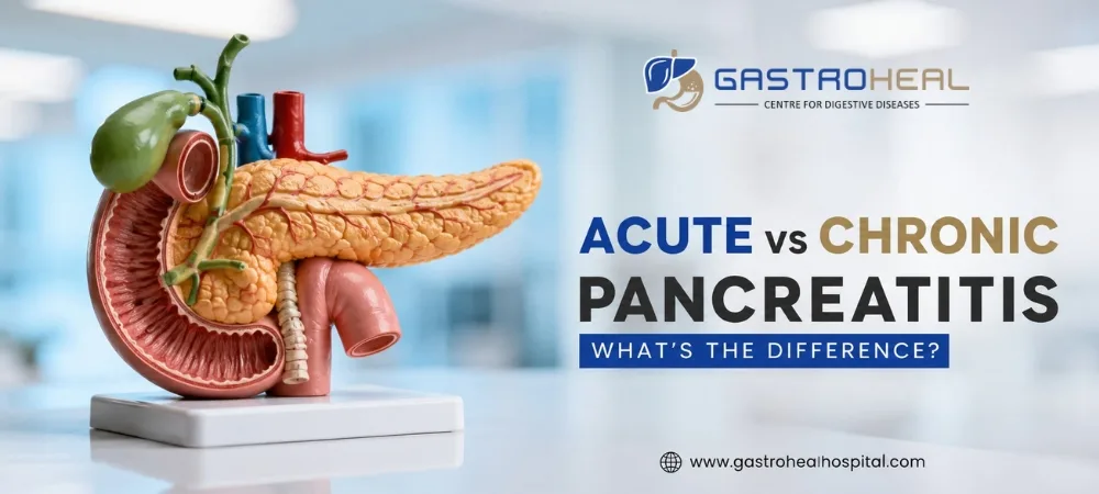 Acute pancreatitis