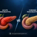 Pancreatitis treatment