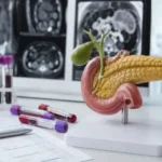 Pancreas Specialist Anand Gujarat