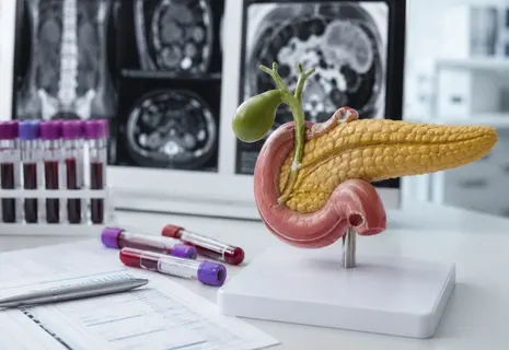 Pancreas Specialist Anand Gujarat